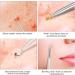 Blackhead Remover Tools 7Pcs Set with Tin Case by JAZZZNAP - Silver Zit Extractor Kit - Buy Online on GoSupps.com