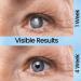 Moisturizing Eye Drops for Cataract & Glaucoma | Antioxidant Eye Drops for Dry Eyes (30 Pieces/3 Boxes) - International Shipping - Buy Online on GoSupps.com