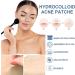 Acne Pimple Patches - Absorbing Cover with Tea Tree Oil Invisible Blemish Spot Hydrocolloid Skin Treatment Facial Stickers Five Sizes Blends in with skin - Buy Online on GoSupps.com
