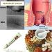 6PCS Chinese Herbal Hemorrhoids Cream | Painless Relief | Maximum Strength Anal Cream - Buy Online on GoSupps.com