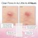 Grace & Stella Pimple Patches for Face - 72 Hydrocolloid Acne Patches | Vegan & Cruelty-Free Blemish Stickers Dermatologist Tested - Buy Online on GoSupps.com