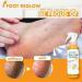 Foot Peeling Spray Orange Oil Exfoliating Foot Moisturizing Hydrating Nourish Peel Off Spray Remove Dead Skin And Calluses On Feet Gentle Foot Care. (Green Tea) - Buy Online on GoSupps.com