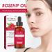 Organic Bio-Hageboten Oil - Cold-Pressed Rosehip Facial Oil for Scars & Stretch Marks | 30ml Ethereal Hydrating Massage Oil - Buy Online on GoSupps.com