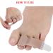 14-Piece Broken Toe Wraps & Hammer Toe Separator Splints Set - Buy Online on GoSupps.com