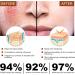 Rosacea Face Serum Face Serum Hyaluronic Acid Face Oil Anti-Aging Relieve Redness &Quick Repair Damage Skin Niacinamide Serum Replumps & Hydrates Collagen Face Serum-Protect Skin+Reduce Acne-Women 1 - Buy Online on GoSupps.com