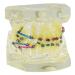 Dental Orthodontic Demonstration Model Treatment with Arch Wire Metal Bracket For Teaching Study (clear)