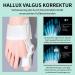 Melarqt Adjustable Hallux Valgus Correction Rail - Unisex Big Toe Straightener for Day & Night Relief (Left/Right Foot) - Buy Online on GoSupps.com