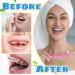 8 Pcs Interspace Toothbrush Soft Single Tufted Toothbrush with Cover Slim Interspace toothbrushes interdental Brushes for Orthodontic Braces Detail Cleaning(Blue/Green/Rose Red/White) - Buy Online on GoSupps.com