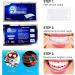 Teeth Whitening Strips - 14PCs Professional Safe Whitening | Advanced No-Slip Technology for Effective Enamel Care - Buy Online on GoSupps.com