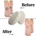 Buy 2 Pieces Natural Pumice for Feet & Body Care | Effective Pedicure Tools for Dead Skin Peeling - Buy Online on GoSupps.com