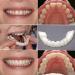 Cosmetic Teeth Veneers - Instant Perfect Smile with Provisional Dentures | Upper & Lower Snap-On Whitening Teeth - Buy Online on GoSupps.com