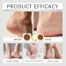  laxreheye Women's hand cream anti-crack heel softener - Moisturizing lotion for dry hands dead skin feet calluses men young people athletes healthy fingers - Buy Online on GoSupps.com