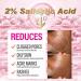 Salicylic Acid Acne Spot Removal Cream - Control Breakouts Clear Pimples & Blackheads | 1.76 oz Refreshing Formula for Acne-Prone Skin - Buy Online on GoSupps.com