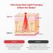 Opove Red Light Therapy Belt for Tissue Repair & Pain Relief | Near-Infrared 660nm & 850nm Wavelengths | Flexible Portable Lipo Wrap for Joints & Back - R1 Gray - Buy Online on GoSupps.com