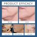 Skin Firming Body Lotion - Body Moisturiser - Body Lotion for Dry Skin - Anti-wrinkle Friming Body Lotion - Skin Firming Rejuvenation Body Cream - Improve Skin Elasticity & Texture - Buy Online on GoSupps.com