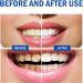 SP10 Probiotic Toothpaste - Ultra Whitening Formula for Fresh Breath | 1 Pcs - International Shipping Available - Buy Online on GoSupps.com