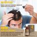 SALUBRITO 5% Biotin Minoxidil Hair Growth Oil 120ML - Hair Loss Treatment for Men & Women - Thickening & Regrowth Serum - Two Months Supply - Buy Online on GoSupps.com