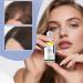  Yuemxixi Hair Regrowth Natural Scalp Care Roller 30ml Natural Hair Thickening and Growth | For Frizz Follicles Slimming Health Men Seniors Home Travel - Buy Online on GoSupps.com
