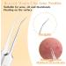 JIEYAO 4-Piece Tweezers Set for Removing Blackheads Pimple Ejector Tool Set Blackhead Extractor Tweezers for Whiteheads Blemishes Comedones Make-Up Tool Made of Stainless Steel - Buy Online on GoSupps.com