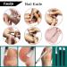 Ingrown Toenail Clippers & Pedicure Kit - Foot Care Tools for Thick Nails, Nail Lifter, Cutter, Cuticle Manicure Set - Buy Online on GoSupps.com