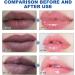 Pure Natural Melanin Reducing Lipstick ZrT200 (White One Size) 1 count (Pack of 1) White - Buy Online on GoSupps.com