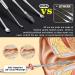 Professional 9 PCS Blackhead & Earwax Removal Kit - Stainless Extractor & Pimple Popper Tools Set with Cleaning Brush and Storage Box - Buy Online on GoSupps.com