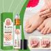 Nail Repair Treatment | Stick Applicator for Brittle Toenails Nourishing Fortifier for Manicures at Home or in Salons 10 ml - Buy Online on GoSupps.com