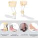 ZJchao Ankle Support Brace - Lightweight & Tailorable Ankle Foot Orthosis for Sprains Drop Foot Stabilization - International Shipping Available - Buy Online on GoSupps.com