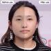 Liuchanghe Gua Sha Stainless Steel Facial Tool | Gua Sha Scraping Massage for Face Eyes Neck & Body - Shop Internationally - Buy Online on GoSupps.com