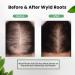 Natural Hair Growth Oil | Rosemary Biotin & Castor Oil | Stronger Thicker Hair for Men & Women - Ships Internationally - Buy Online on GoSupps.com