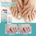 Fungal Nail Treatment | Strengthens Toenails | Toe Nail Fungus Solution - Buy Online on GoSupps.com