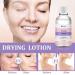 SIRUIMAO Stubborn Acne Drying Lotion - Overnight Acne Spot Treatment for Face & Body - 1 Fl Oz (Pack of 1) - Buy Online on GoSupps.com