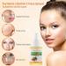 Turmeric & Vitamin C Dark Spot Corrector Serum | Anti-Aging & Moisturizing Formula for All Skin Types - 1oz - Buy Online on GoSupps.com