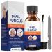 Nail Fungus Treatment for Toenail, Toenail Fungus Treatment, Toe Nail Fungus Treatment Extra Strength, Fungus Nail Treatment, Nail Fungus Treatment for Nail, Fungus Treatment for Fingernails 30ML Deep Blue