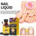 Fungal Nail Treatment For Toenails Extra Strong - Nail Fungus Treatment - Moisturize Cuticle Care Oils for Ingrown Toenails - Toenail Growth for Repairing Damaged & Discolored Nails(30ML) - Buy Online on GoSupps.com