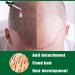 Ginger Anti Hair Loss Serum for Hair Regrowth - Men & Women - 3pcs 1 Fl Oz - Buy Online on GoSupps.com