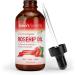 100% Pure Rose Hip Kernel Oil 120ml | Premium Quality | Natural Skincare & Anti-Aging | International Shipping - Buy Online on GoSupps.com