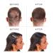 PROCOVR Hair Loss Concealer Cream with DHT Blockers - Saw Palmetto & Rosemary Extract | Hairline Enhancer & Root Touch Up | Natural Alternative to Hair Fibers & Powder - Buy Online on GoSupps.com