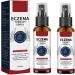 MUTYNE Eczema Therapy Spray Natural Eczema Relief Spray Eczema Hydrating Cream Fast Acting Itch Relie Soothe Dry Skin (2PCS)