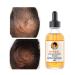 Hair Growth Oil for Women Men  Hair Growth Serum Oil with Tumeric  Hair Thickening Products for Women  Hair Strengthening Oil Hair Treatment for Split Ends Dry Scalp Hair Growth for Fast Results -2OZ