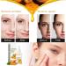 Turmeric Serum Dark Spots 30 ml Spot Corrector Face & Body Anti Aging and Wrinkle Face Serum Reduces Hyperpigtation Age Spots Sun Spot Improve Skin Tone Moisturize Brighten All Types - Buy Online on GoSupps.com