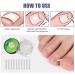 Ingrown Toenail Removal Kit - Corrector Strips, Pedicure Tool, Braces, Patch & Protectors - Buy Online on GoSupps.com