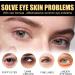 Caffeine Solution 5% + EGCG Eye Serum Caffeine Eye Serum Under Eye Cream for Dark Circles and Puffy Eyes Under Eye Serum Caffeine Eye Cream for Eye Bags Remover Dark Circles under Eye Treatment Women 1 - Buy Online on GoSupps.com