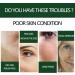 Skin Firming Rejuvenating Serum Skin Firming Serum for Face and Neck Hyaluronic Acid Facial Serum Refreshing and Non-sticky For All Skin Types - Buy Online on GoSupps.com