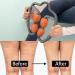 MZDXJ Fascia Muscle Roller - Cellulite Massager for Trigger Points - Reduce Soreness, Tightness in Calves, Legs, Arms & Shoulders - Deep Tissue Massage Tool in Orange Gray - Buy Online on GoSupps.com