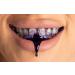 SPARX Purple Toothpaste - Teeth Whitening Stain Removal & Smile Brightener 1 fl oz - International Shipping Available - Buy Online on GoSupps.com