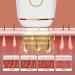 Gerrit IPL Hair Removal Laser - Smooth Skin for Face Legs Armpits & Bikini Zone | Smart Rejuvenating IPL Technology - Buy Online on GoSupps.com