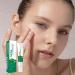 Anti Acne Face Cream Tea Tree Face Acne Gel Acne Scar Treatment Spot Cream for Acne Treatment and Spot Treatment Acne Cream Spot Treatment for Face Acne Scar Removal Cream Acne Moisturiser Face - Buy Online on GoSupps.com