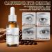 2PCS Caffeine Solution 5% + EGCG S rum pour les yeux la caf ine Contour des Yeux Anti Rides Anti- ge Aide R duire les Cernes et les Poches Serum Yeux pour hommes et femmes 30ml A-2 - Buy Online on GoSupps.com