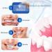 Effective Tooth Whitening Strips | Quick Teeth Bleaching at Home | Remove Deep Stains & Lighten Results - Buy Online on GoSupps.com